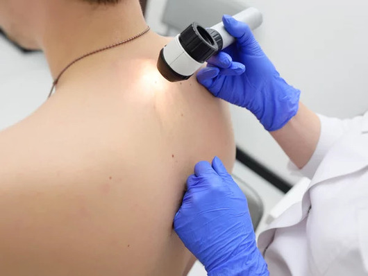 117341_gold_hautkrebsuntersuchung